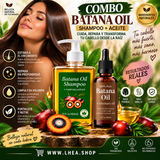 SHAMP00 + ACEITE DE BATANA